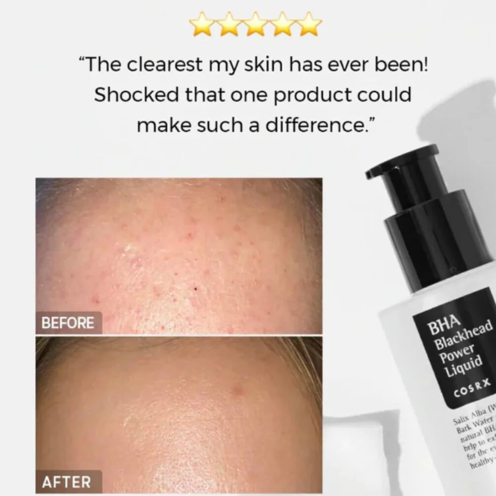 COSRX BHA Blackhead Power Liquid 100ml - Image 2