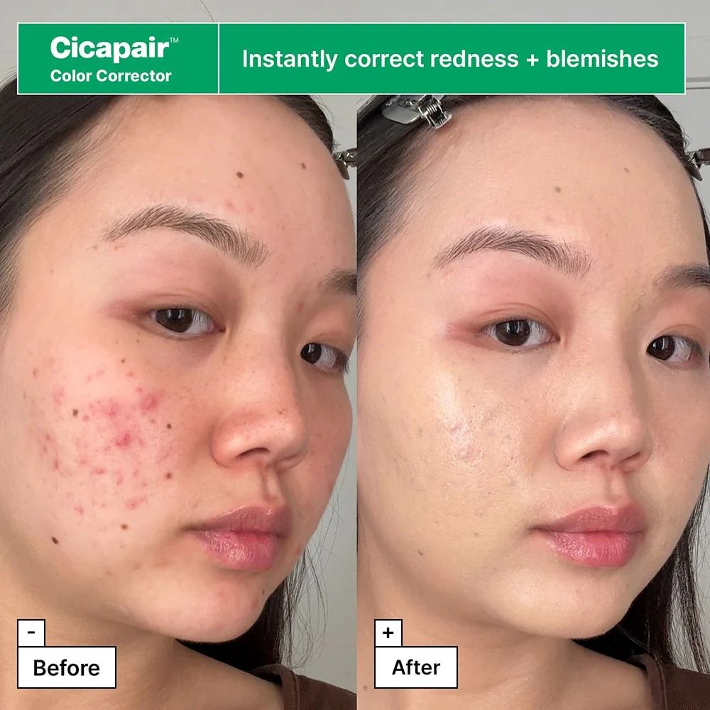 Dr Jart Kit Cicapair Redness Rescue Regimen 4 Und - Image 2