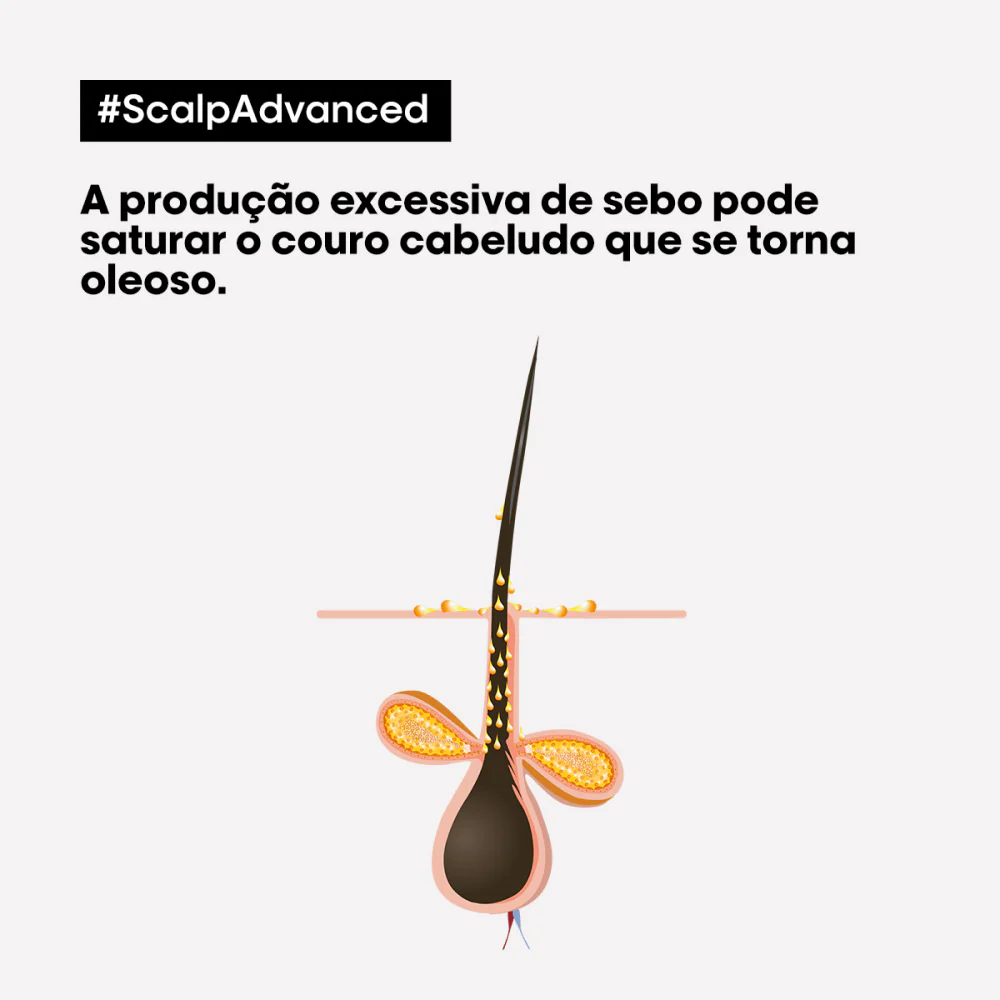 L'oreal Scalp Advanced Oily Shampoo Serie Expert 1500ml - Image 4