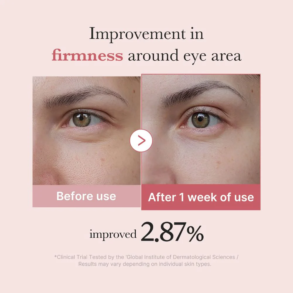 Medicube PDRN Pink Peptide Eye Cream 30ml - Image 2