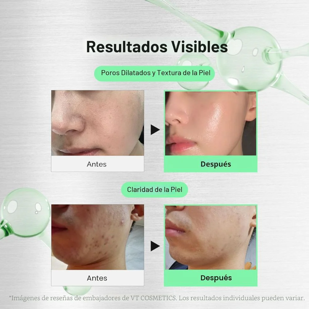 VT Cosmetics Reedle Shot 700 Cica Reedle 30ml - Image 2